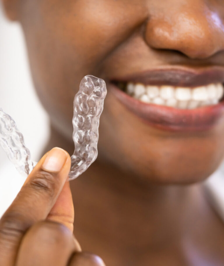 o que é invisalign